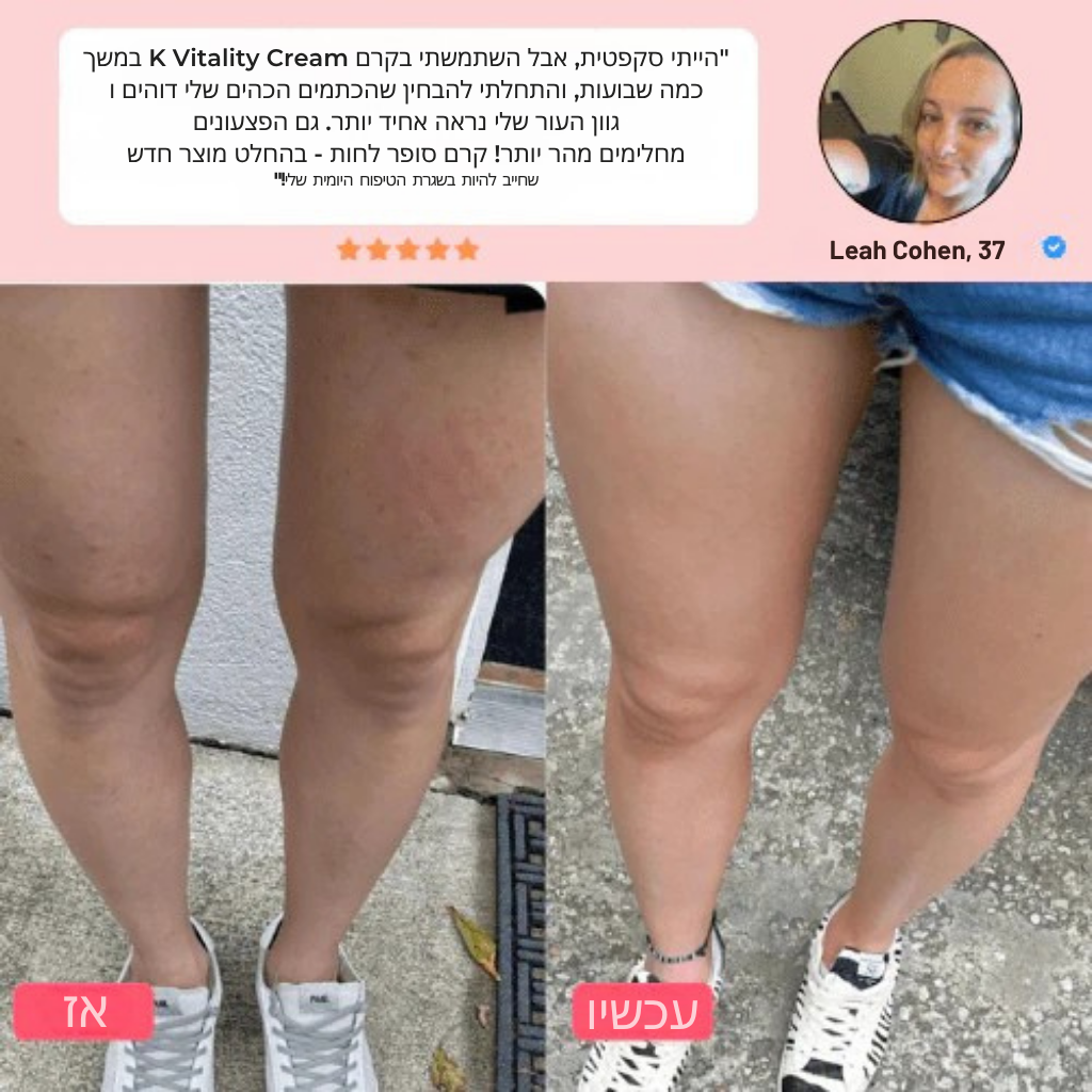 קרם K-Vitality