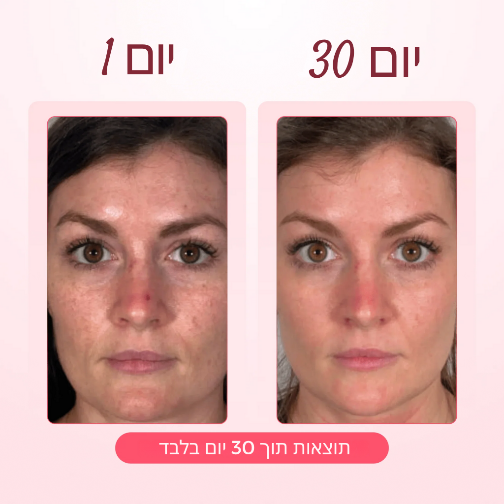 מסכת קולגן זוהרת יוקרתית (תוצאות ברמת ספא)